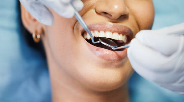Best Emergency Dentist for Knocked-Out Tooth in Salida, CO